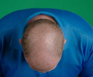 Hair Grow Max 2x1 a 49,99€