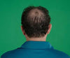Hair Grow Max 2x1 a 49,99€